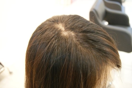 서현헤어크리닉 이미지