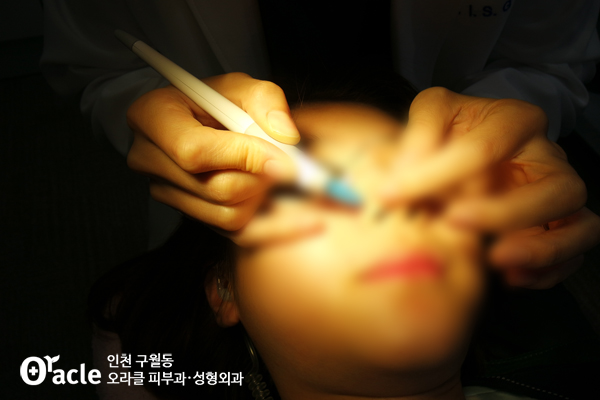 송도오라클피부과 이미지
