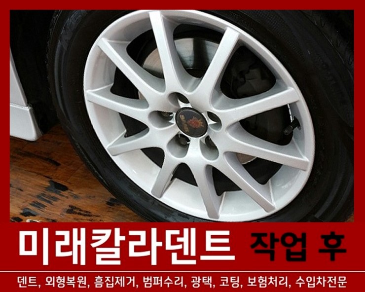 미래덴트칼라 이미지