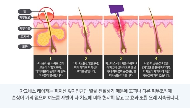 아그네스 이미지