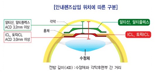 렌즈공간 이미지