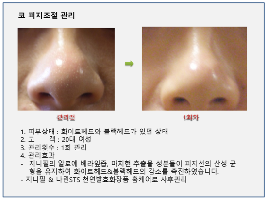 비단궁 이미지