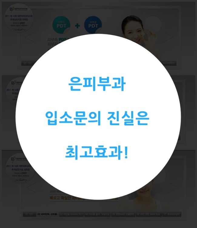 청담피부과 이미지
