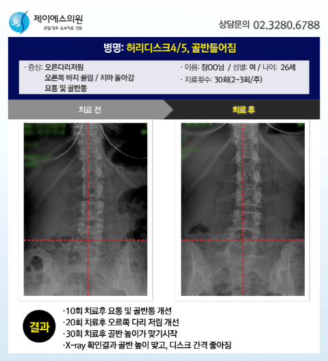 제이에스의원 이미지