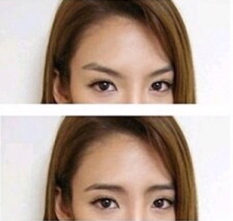 뷰티라이트 이미지