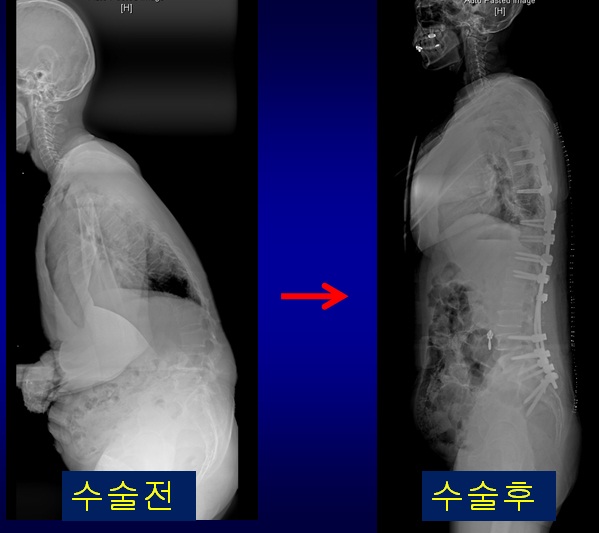 캠토 이미지