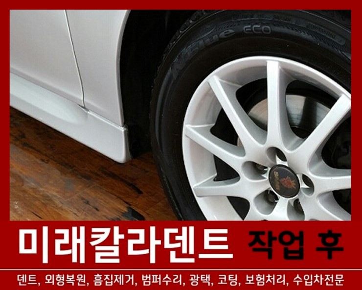 미래덴트칼라 이미지