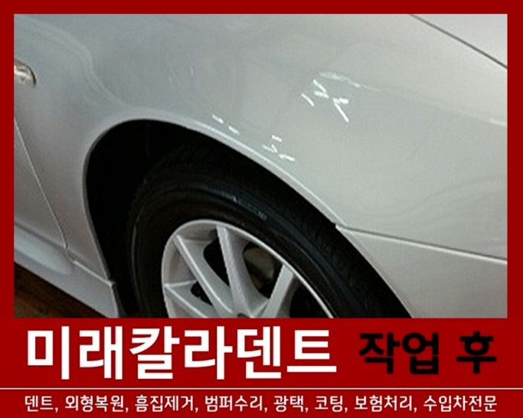 미래덴트칼라 이미지