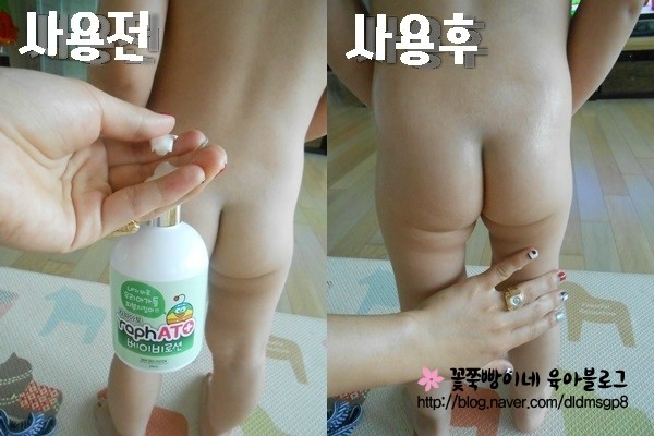 아토제제 이미지