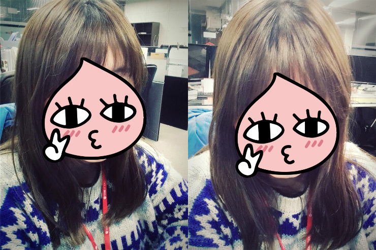 현하윤헤어라인 이미지
