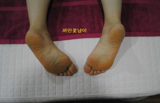 효소체형관리 이미지