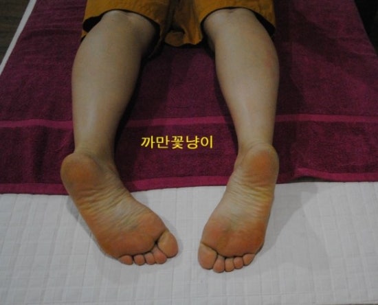 효소체형관리 이미지