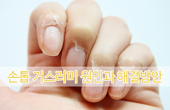 프라임네일 이미지