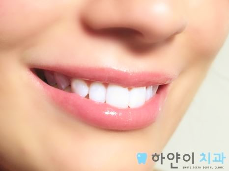 하얀이 이미지