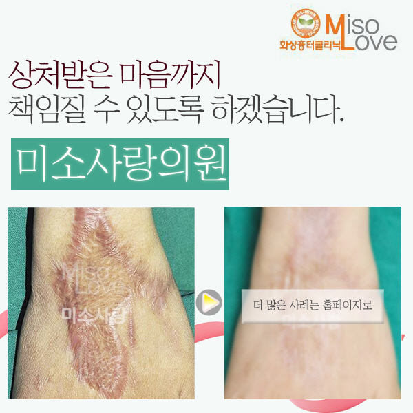 미소사랑의원 이미지