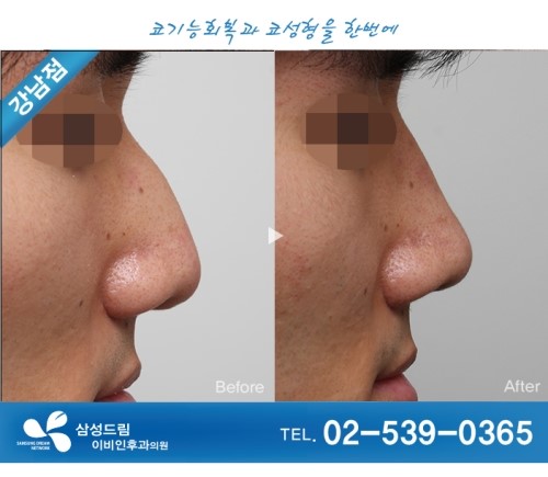 코어디 이미지