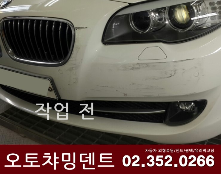오토덴트칼라 이미지