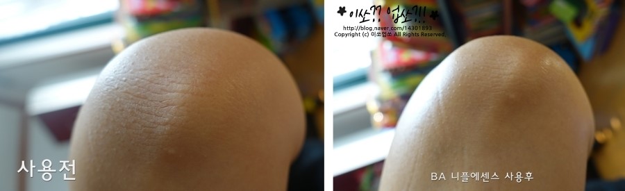 BA플러스 이미지