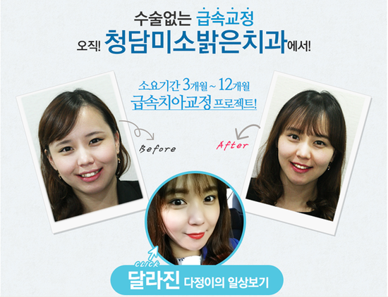 밝은치과 이미지