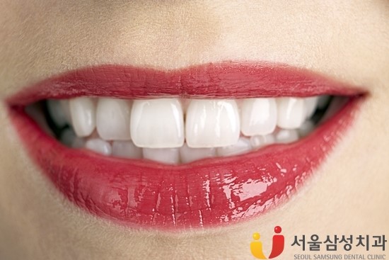 서울삼성치과 이미지