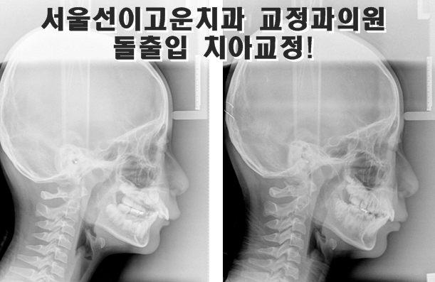 고운얼굴치과의원 이미지