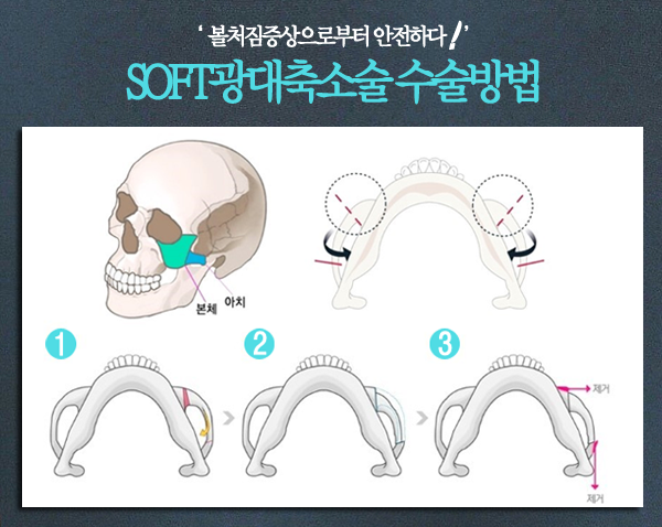 바로소프트 이미지