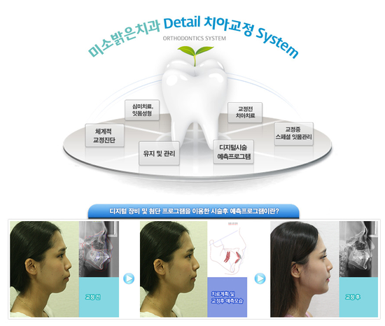 밝은치과 이미지