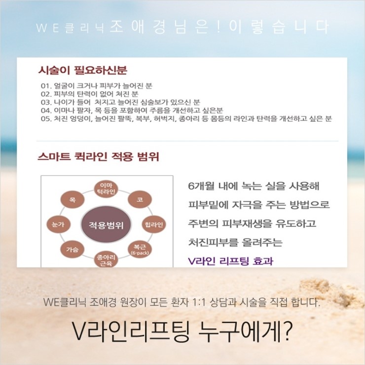 여우라인 이미지
