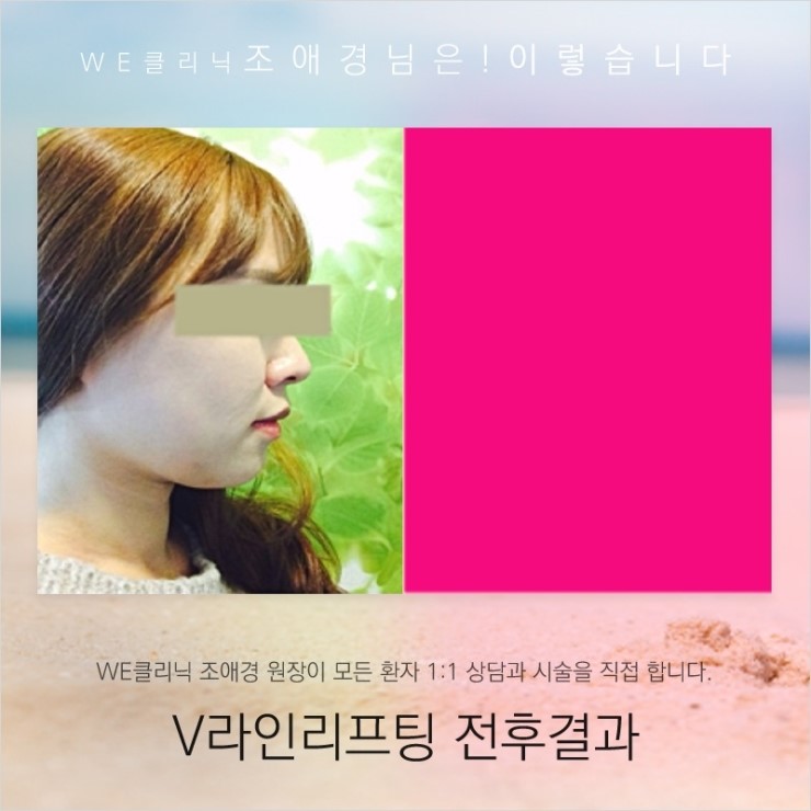 여우라인 이미지