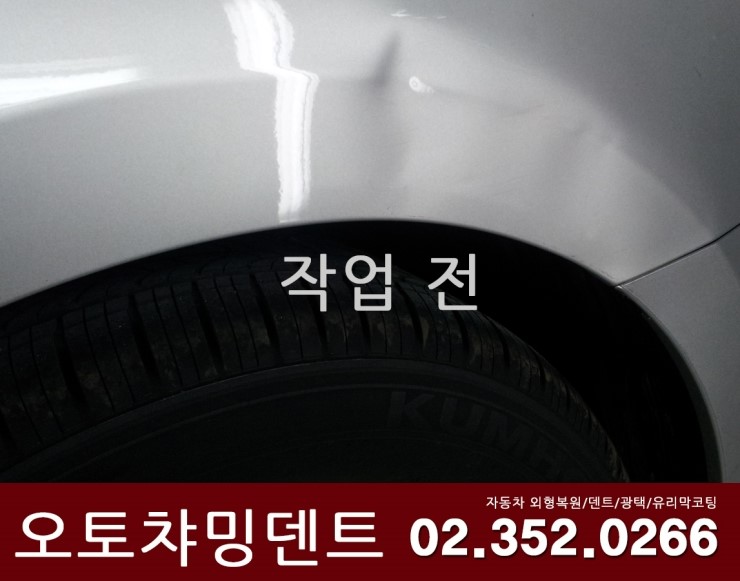 오토덴트 이미지