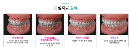 밝은치과 이미지
