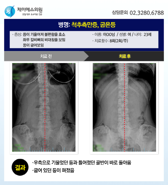 제이에스의원 이미지