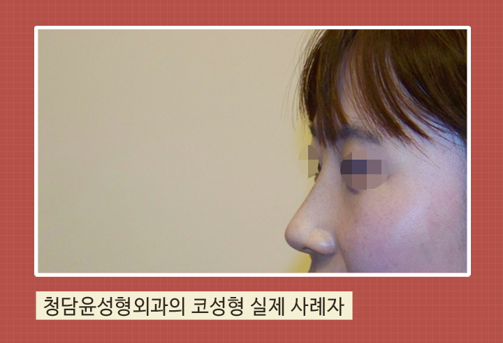 청담윤 이미지
