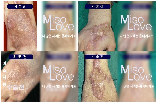 미소사랑의원 이미지