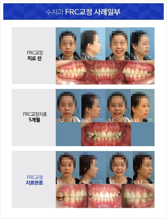 수치과의원 이미지