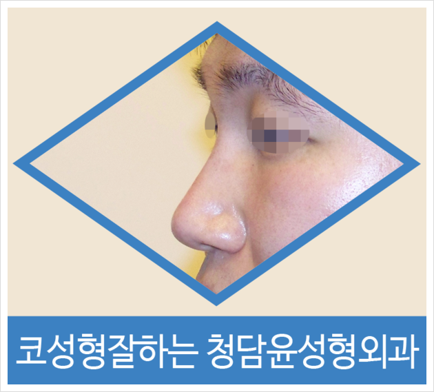청담윤 이미지