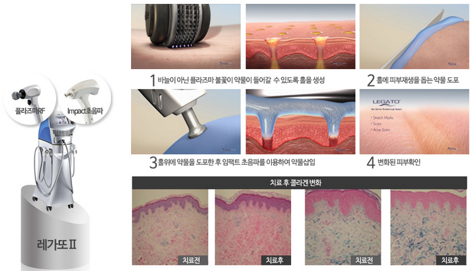 레가토 이미지
