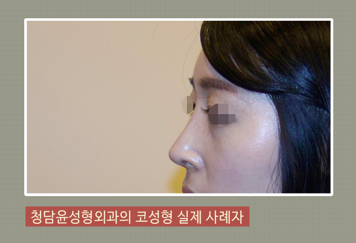 청담윤 이미지