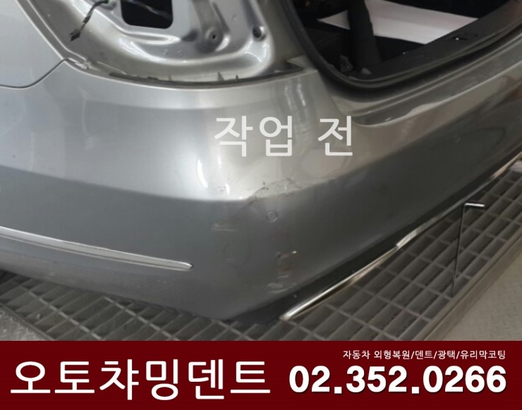 오토덴트칼라 이미지