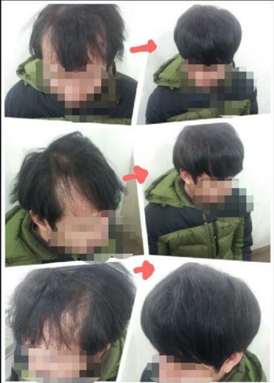 구스헤어 이미지