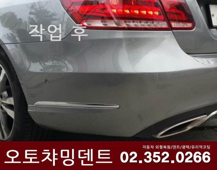 오토덴트칼라 이미지