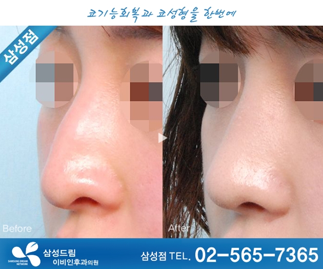 삼성드림이비인후과 이미지