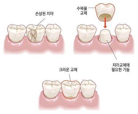 즐거운치과 이미지