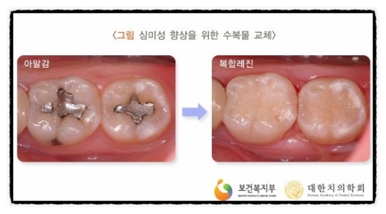 제이엠치과 이미지