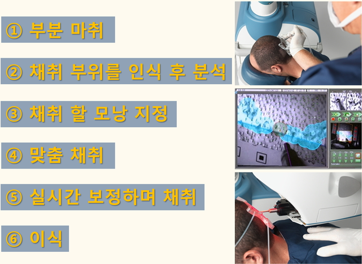 오던모발 이미지