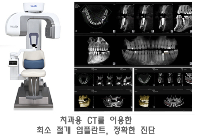 보스톤미소치과 이미지