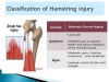 Hamstring Tear   %BD%BD%B6%F3%C0̵%E59.JPG