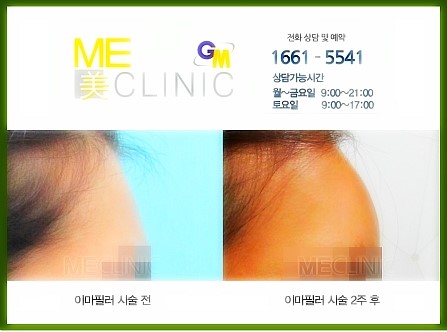 이마테크 이미지