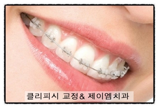 제이엠치과 이미지
