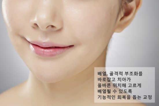 서울모아치과 이미지